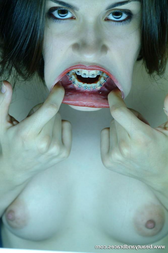 16P Cute brunette teen with braces stretches her mouth wide open