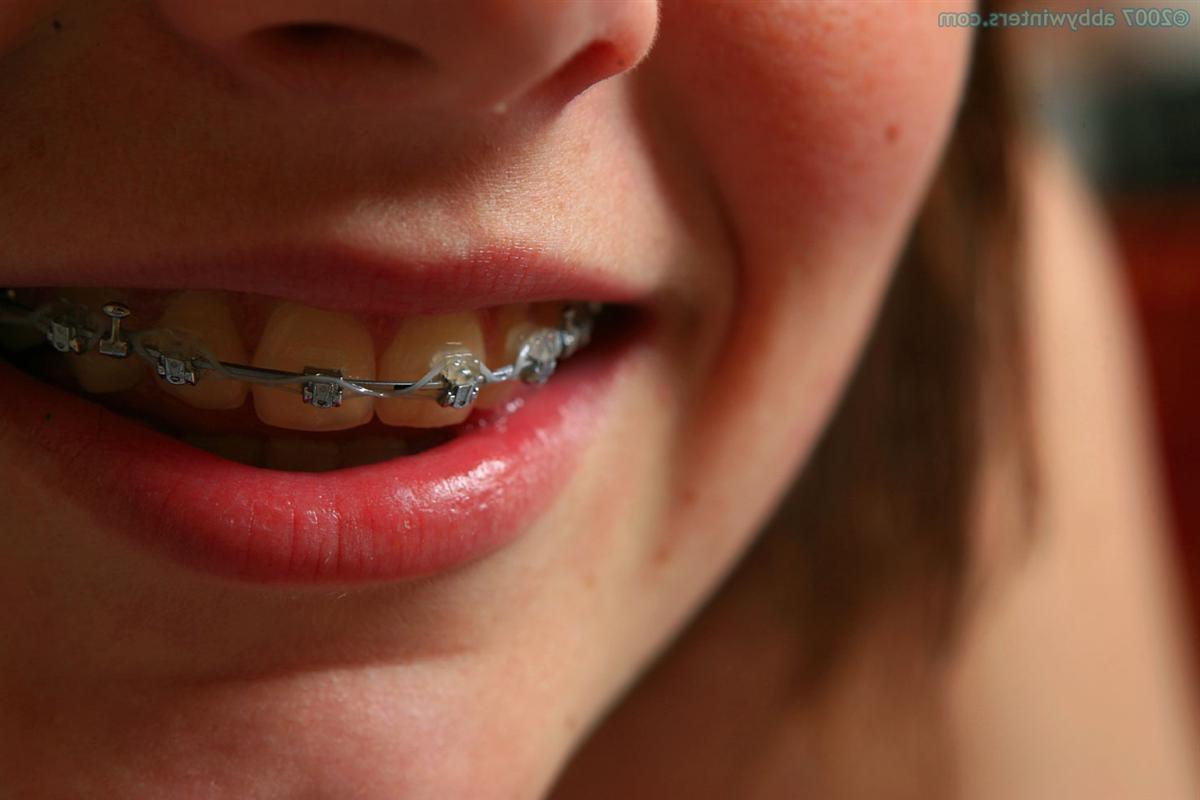 16P Amateur teen with braces fingers her meaty pussy lips