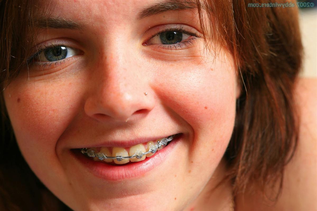 16P Amateur teen with braces fingers her meaty pussy lips