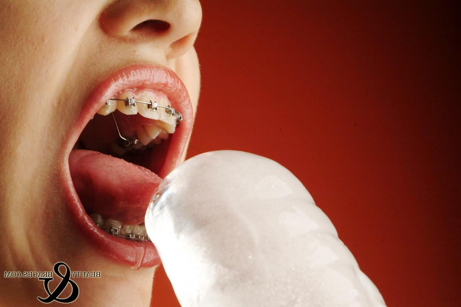 16P Sexy teen with braces sucks a big wet cocksicle