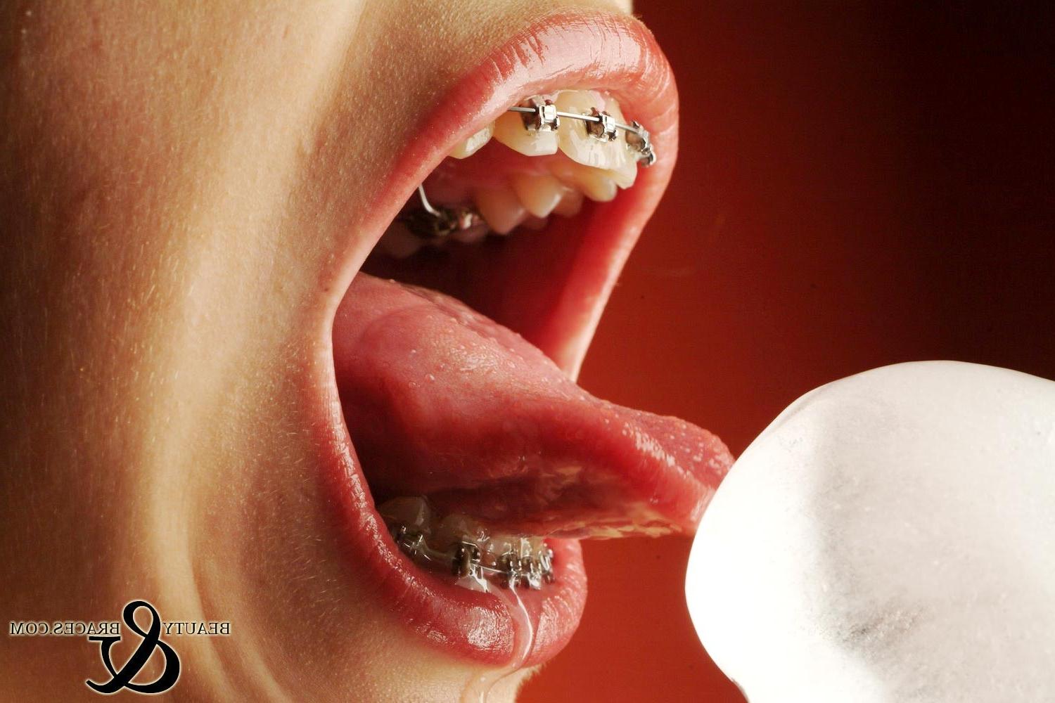 16P Sexy teen with braces sucks a big wet cocksicle