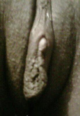 19P Real Thick#2