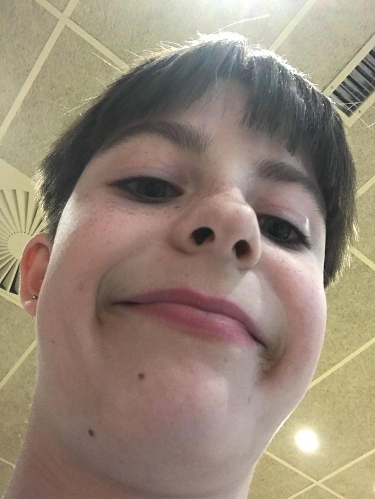 10P Face