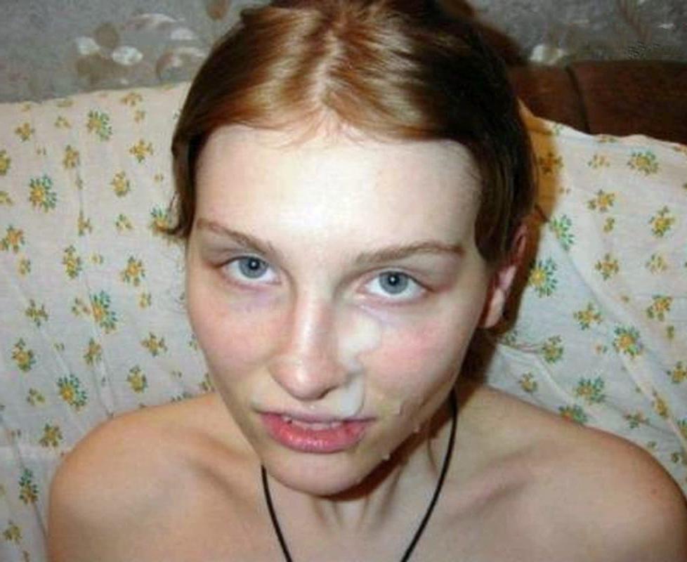 25P Facial 94