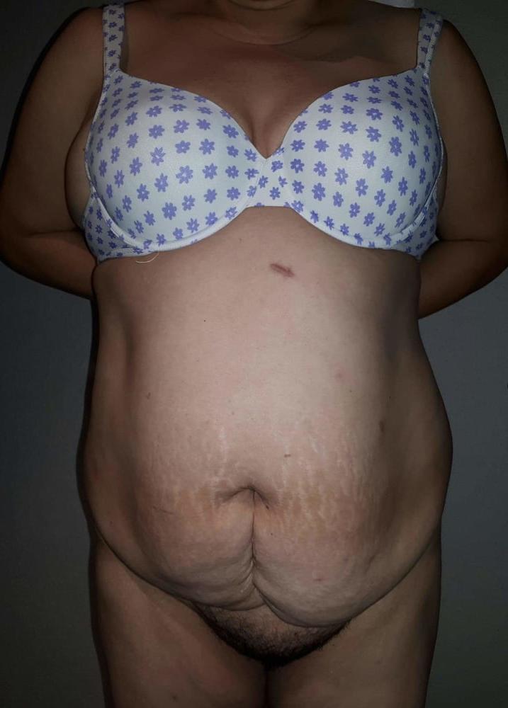 6P Bra Colection