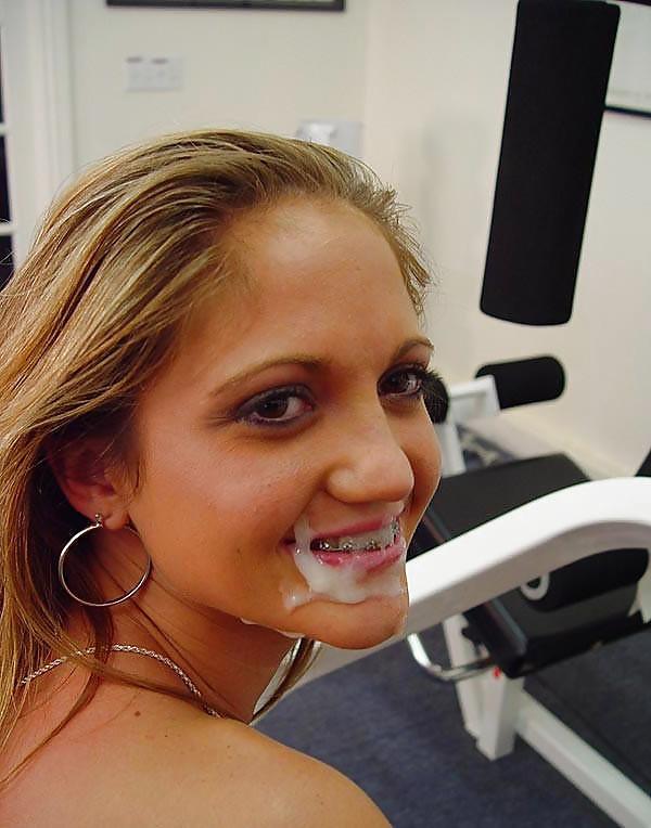 13P Teens -Cum Covered Braces