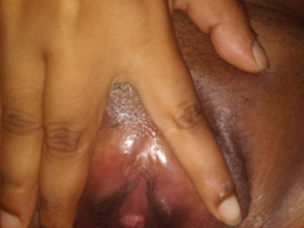 22P stuck Teen 2020