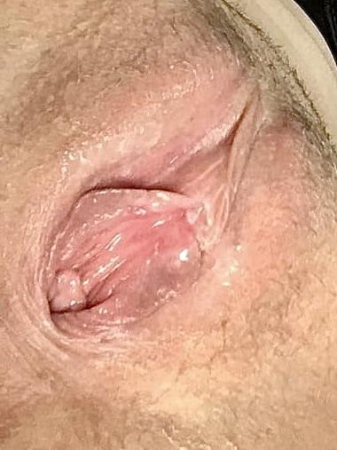 25P Dirty Redhead MILF Loves Cock And Spreading Her Used Cunt