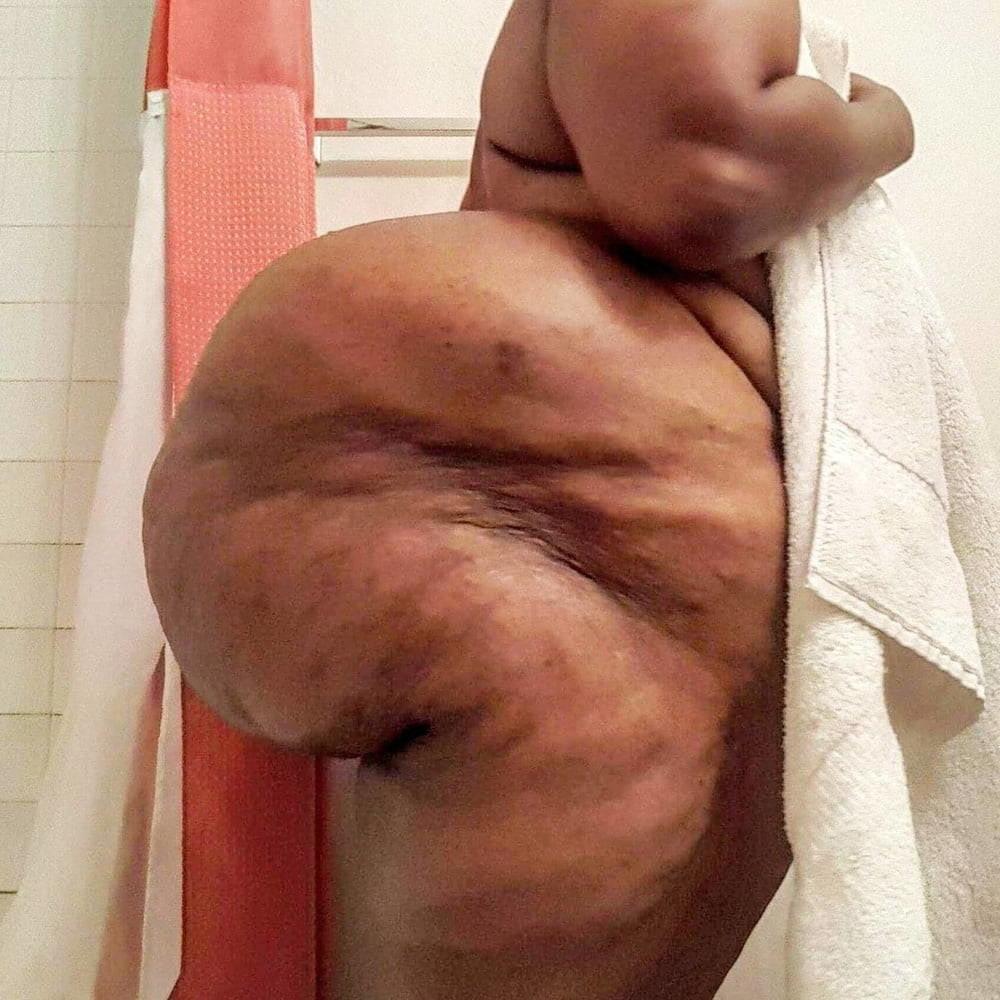 9P Super thick and finE