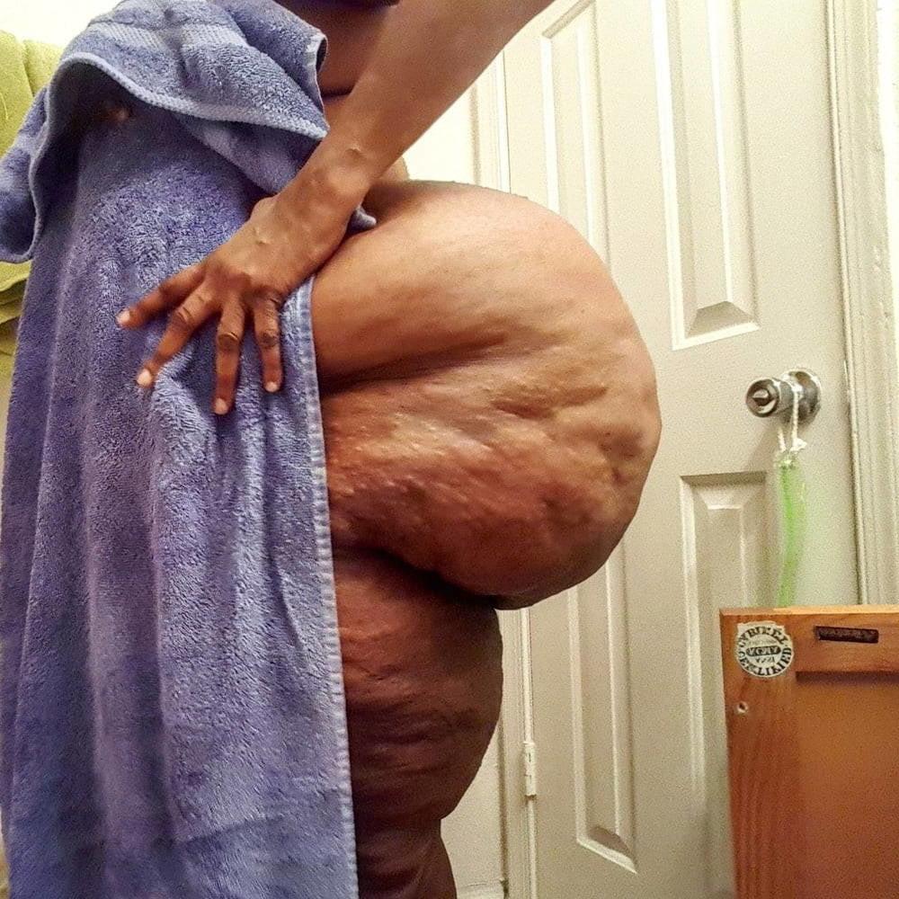 9P Super thick and finE