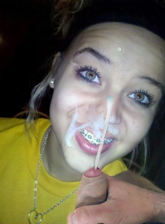 9P Braces