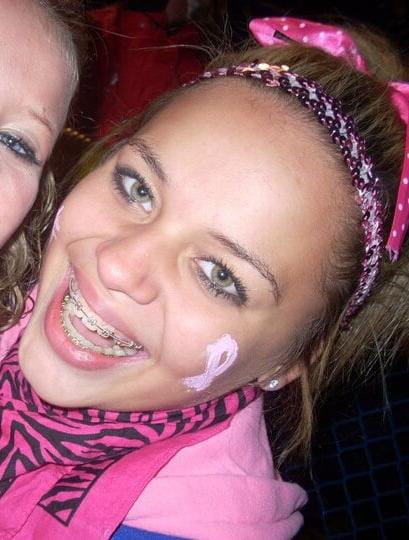 9P Braces