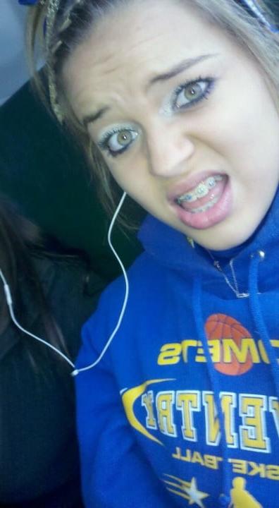 9P Braces