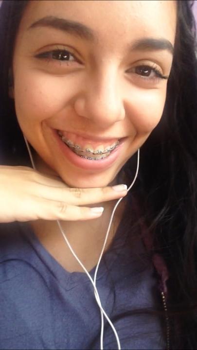 9P Braces