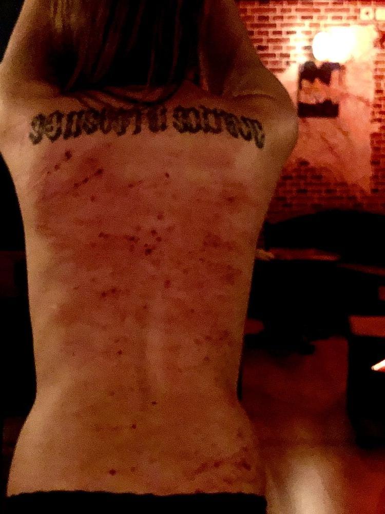 14P Whipped backs of Girls 3