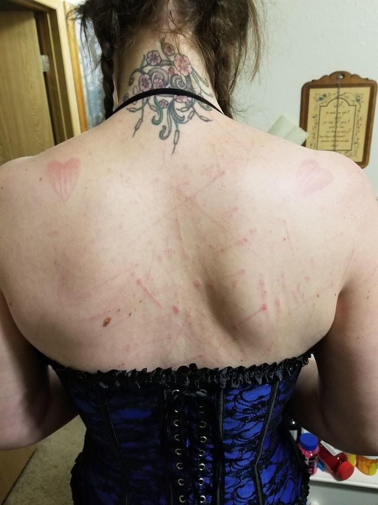 14P Whipped backs of Girls 3
