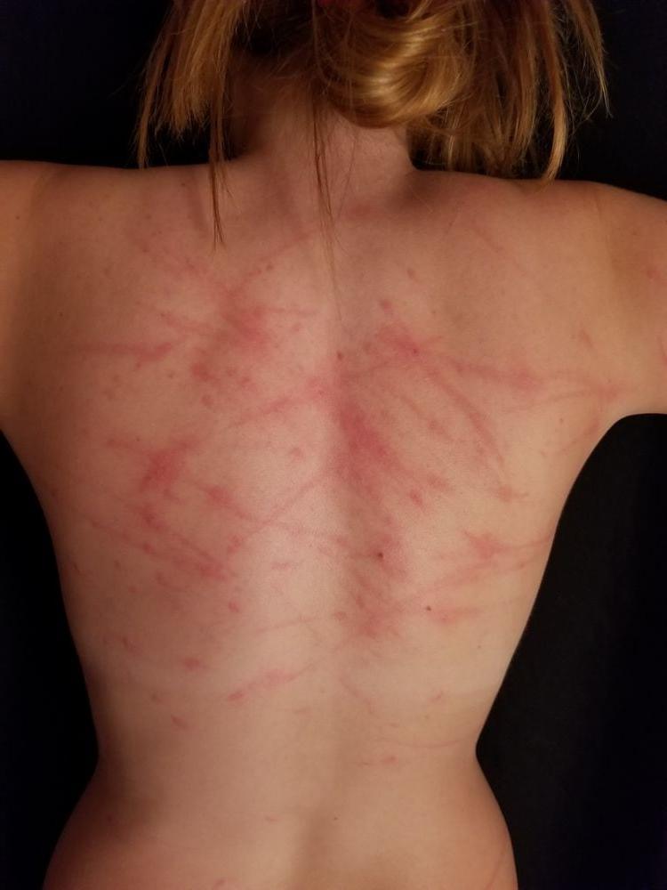 14P Whipped backs of Girls 3
