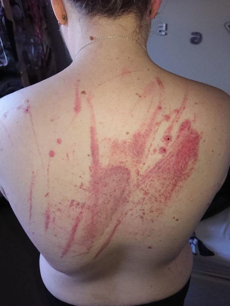 14P Whipped backs of Girls 3