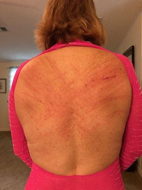 14P Whipped backs of Girls 3