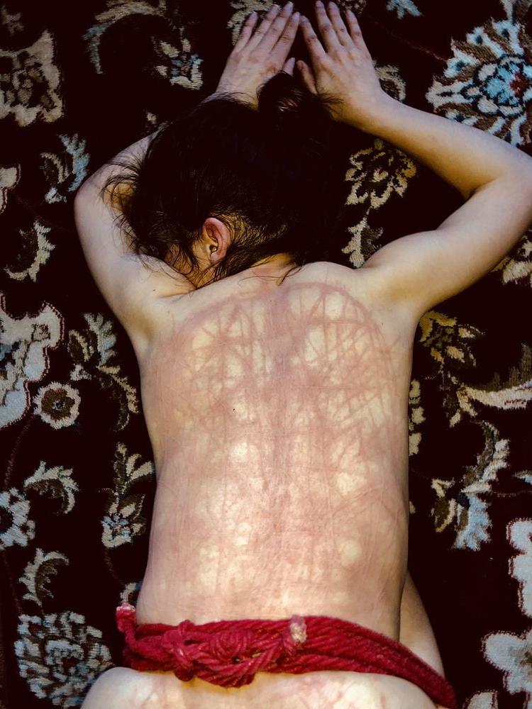 14P Whipped backs of Girls 3