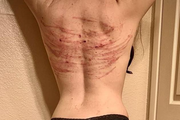 14P Whipped backs of Girls 3