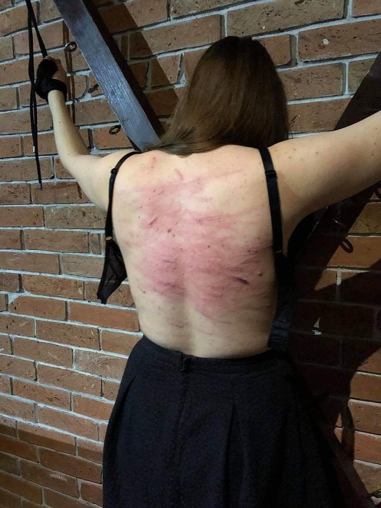14P Whipped backs of Girls 3