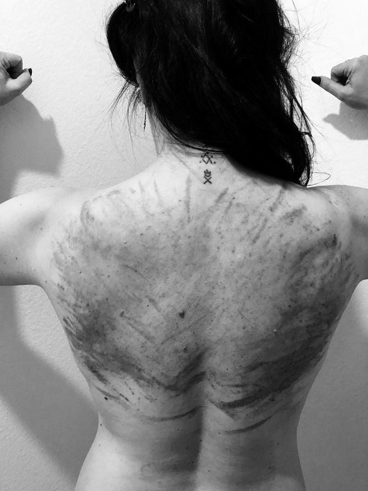 14P Whipped backs of Girls 3
