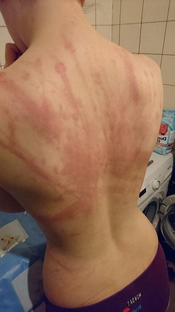 14P Whipped backs of Girls 3
