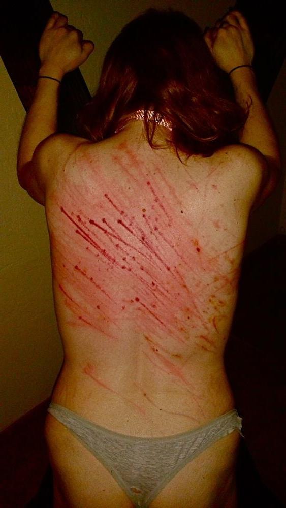 14P Whipped backs of Girls 3