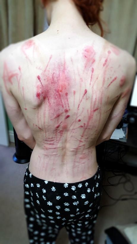 22P Whipped backs of Girls 2