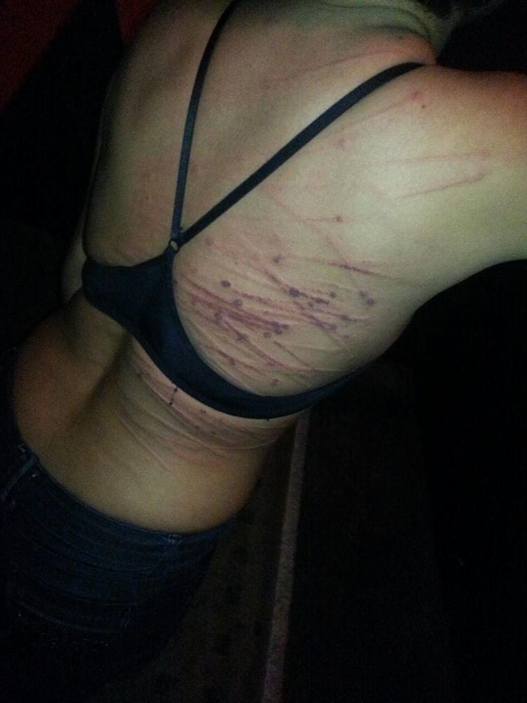 22P Whipped backs of Girls 2