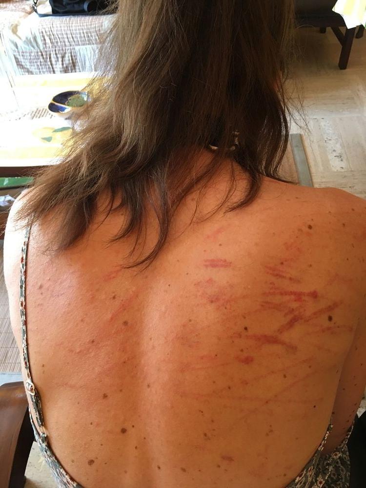 22P Whipped backs of Girls 2