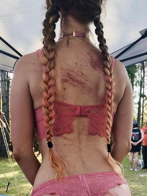 22P Whipped backs of Girls 2