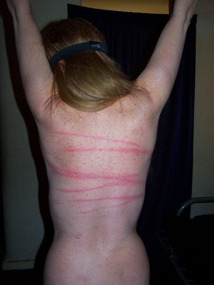 22P Whipped backs of Girls 2