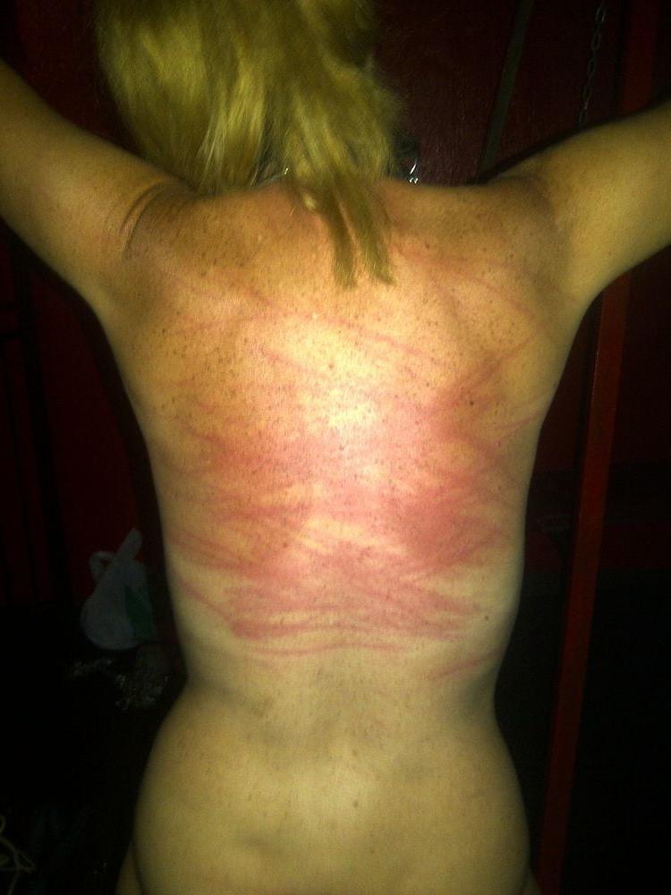 22P Whipped backs of Girls 2