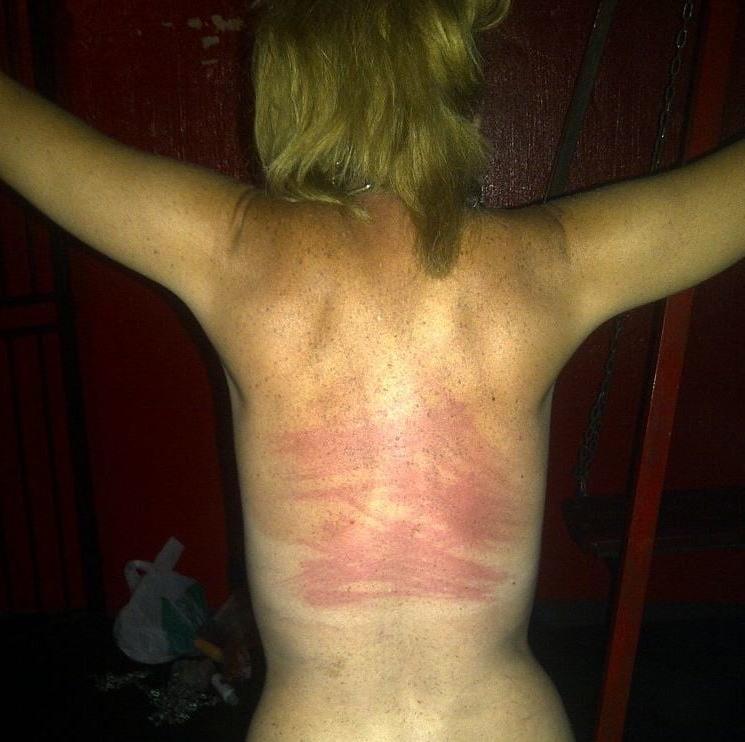 22P Whipped backs of Girls 2