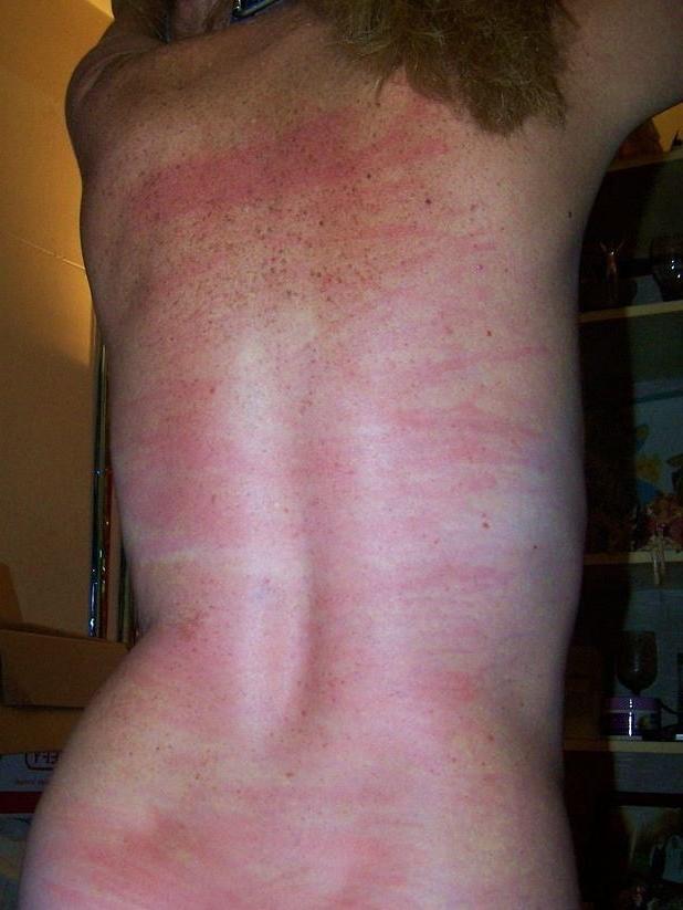 22P Whipped backs of Girls 2