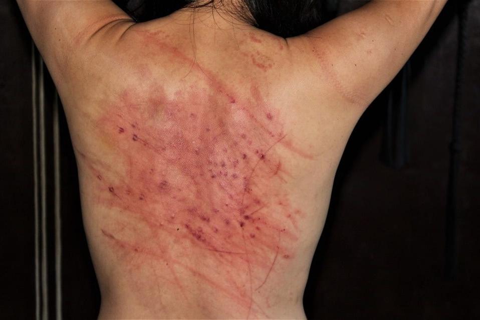 22P Whipped backs of Girls 2