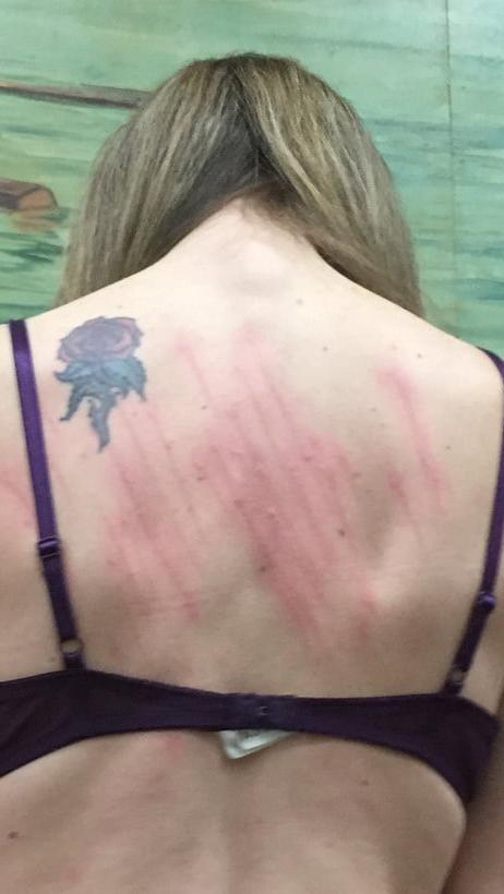 22P Whipped backs of Girls 2