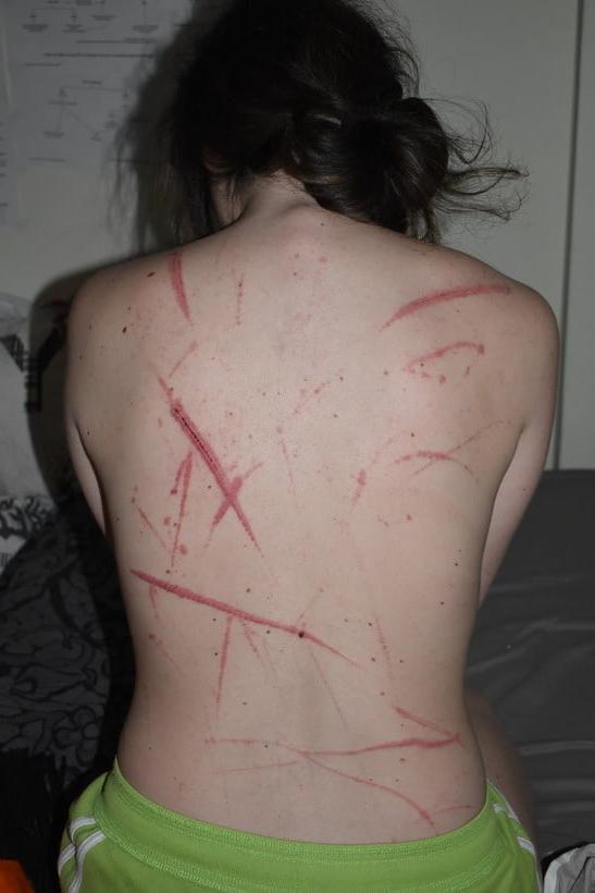 22P Whipped backs of Girls 2