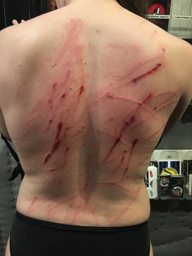 22P Whipped backs of Girls 2