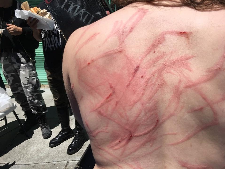 22P Whipped backs of Girls 2