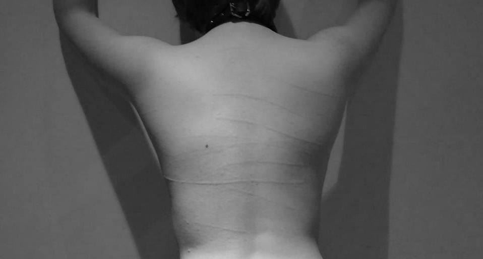 24P Whipped backs of girls