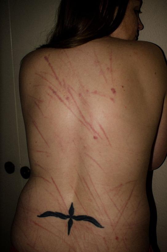 24P Whipped backs of girls