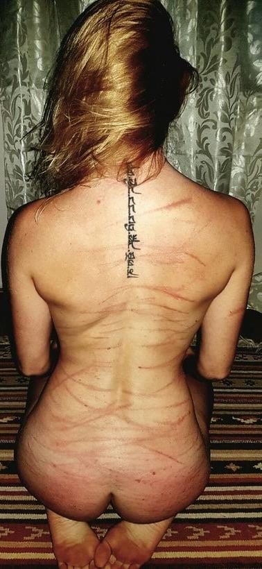 24P Whipped backs of girls