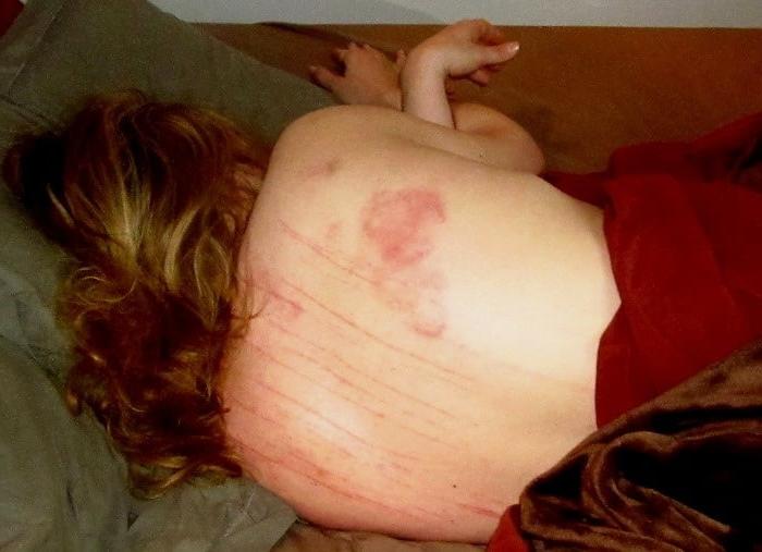 24P Whipped backs of girls