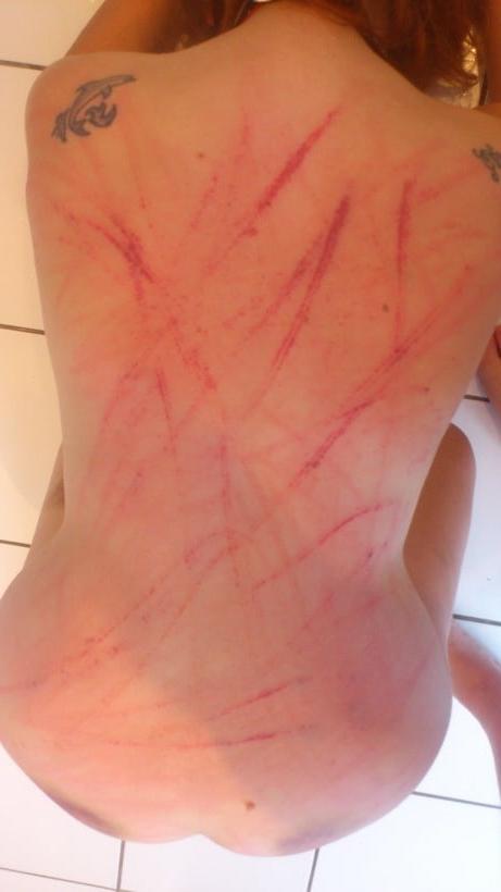 24P Whipped backs of girls