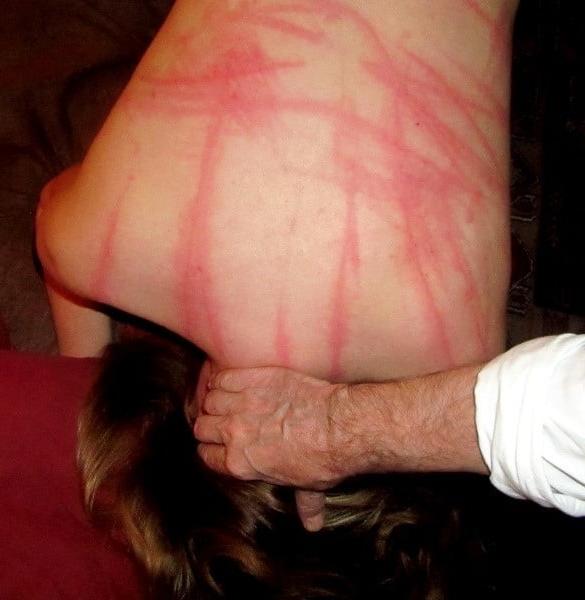 24P Whipped backs of girls