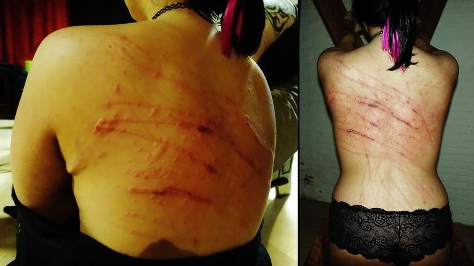 24P Whipped backs of girls