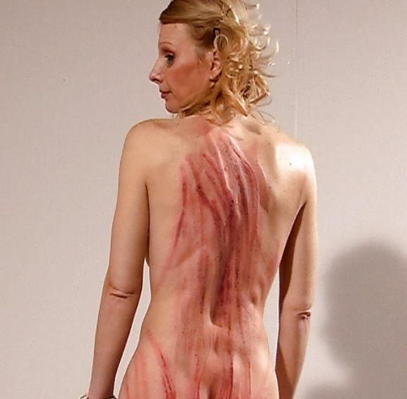 24P Whipped backs of girls